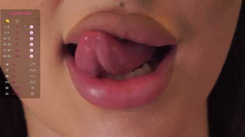 loracopple